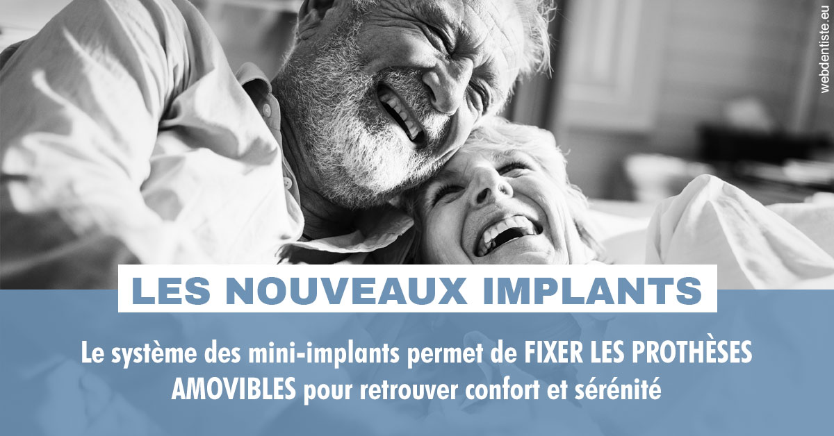 https://dr-laulhere-vigneau-jean-marc.chirurgiens-dentistes.fr/Les nouveaux implants 2