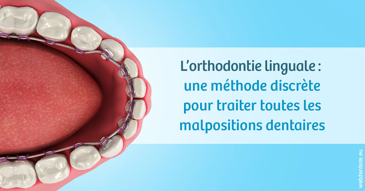 https://dr-laulhere-vigneau-jean-marc.chirurgiens-dentistes.fr/L'orthodontie linguale 1