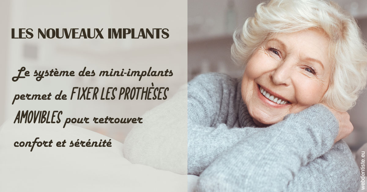 https://dr-laulhere-vigneau-jean-marc.chirurgiens-dentistes.fr/Les nouveaux implants 1