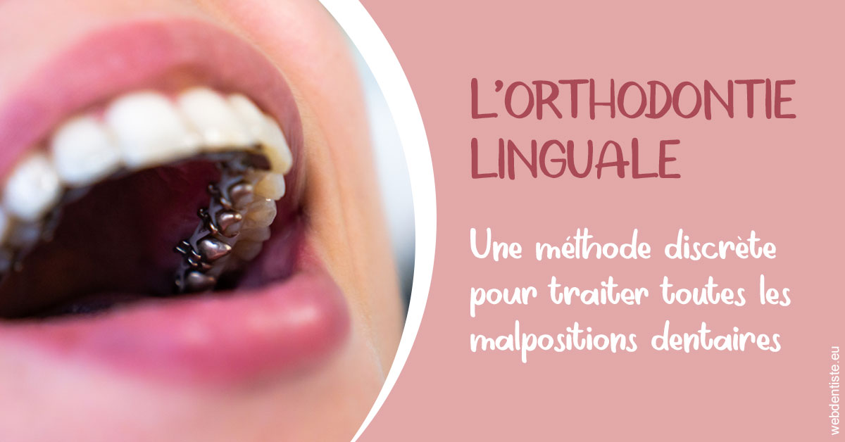 https://dr-laulhere-vigneau-jean-marc.chirurgiens-dentistes.fr/L'orthodontie linguale 2