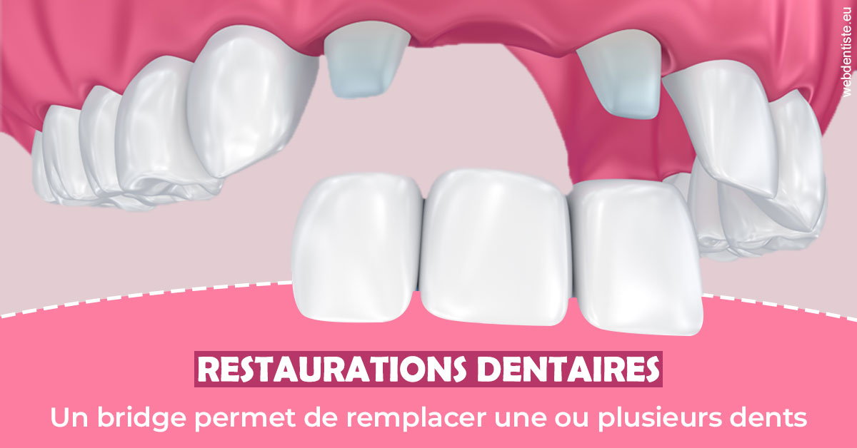 https://dr-laulhere-vigneau-jean-marc.chirurgiens-dentistes.fr/Bridge remplacer dents 2