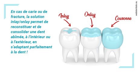 https://dr-laulhere-vigneau-jean-marc.chirurgiens-dentistes.fr/L'INLAY ou l'ONLAY