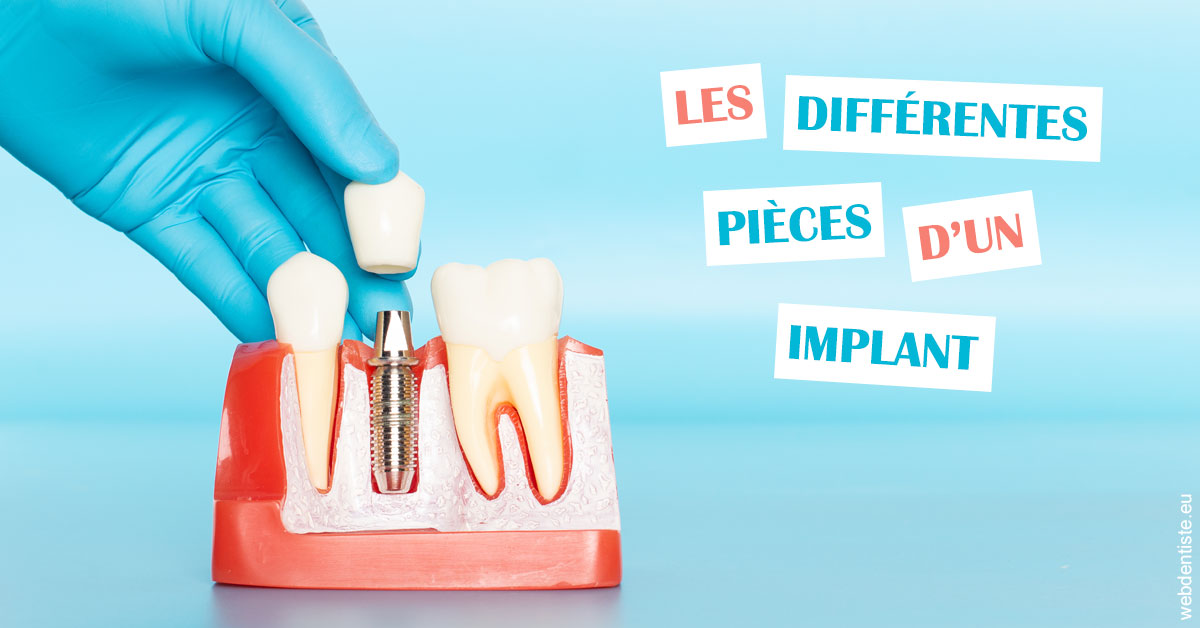 https://dr-laulhere-vigneau-jean-marc.chirurgiens-dentistes.fr/Les différentes pièces d’un implant 2