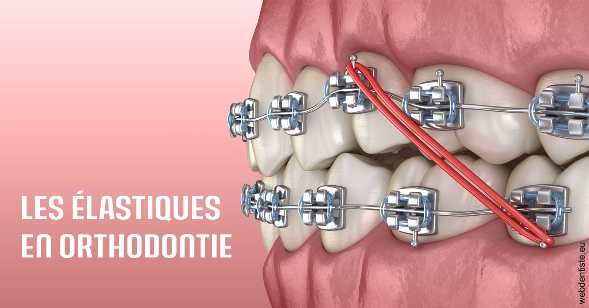 https://dr-laulhere-vigneau-jean-marc.chirurgiens-dentistes.fr/Elastiques orthodontie 2