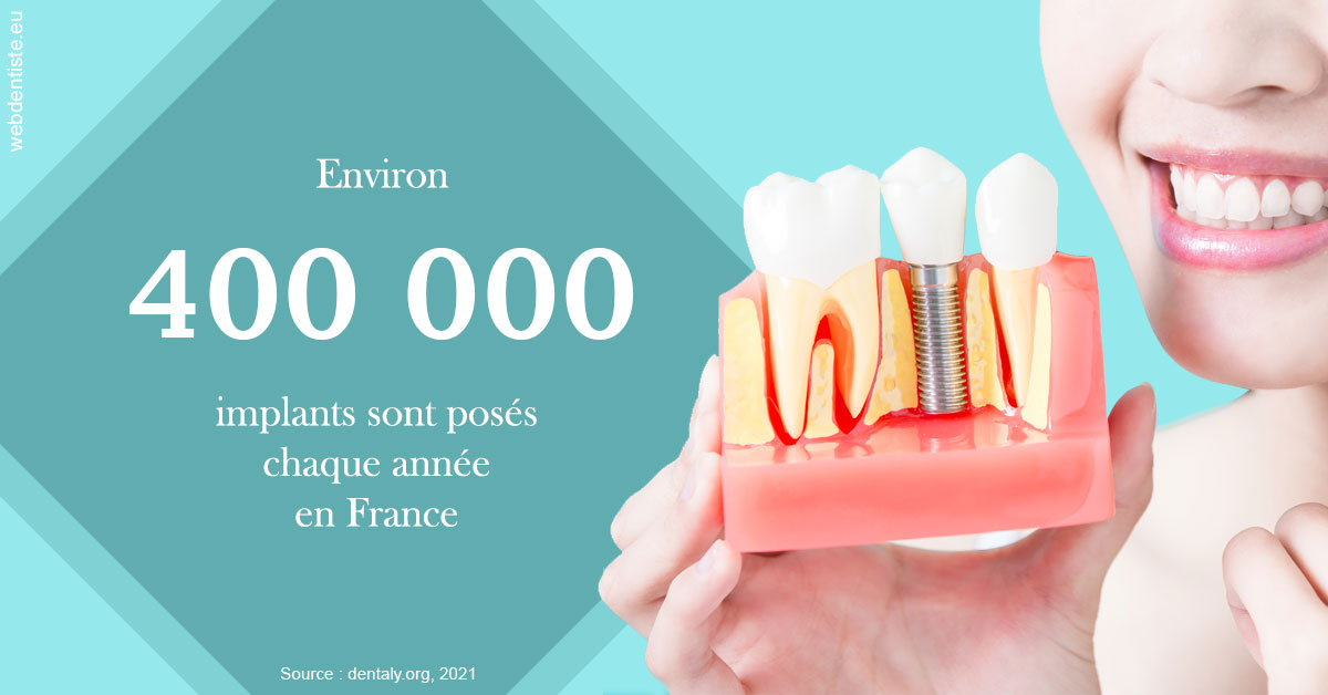 https://dr-laulhere-vigneau-jean-marc.chirurgiens-dentistes.fr/Pose d'implants en France 2